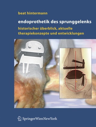 Beat Hintermann - Endoprothetik des Sprunggelenks - Historischer Überblick, aktuelle Therapie und zukünftige Entwicklungen