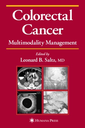 Leonard Saltz, Leonard B. Saltz - Colorectal Cancer - Multimodality Management