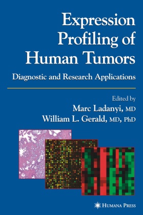 William L. Gerald, Marc Ladanyi - Expression Profiling of Human Tumors - Diagnostic and Research Applications
