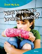 Carol Ballard, Ballard Carol - What Happens to Broken Bones?