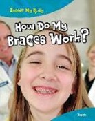 Steve Parker - How Do Braces Work?