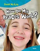 Steve Parker - How Do My Braces Work?
