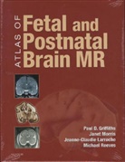 Paul Griffiths, Paul D. Griffiths, Jeanne-Claudie Larroche, Janet Morris, Michael Reeves - Atlas of Fetal and Postnatal Brain MR