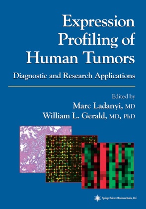 William L. Gerald,  L Gerald,  L Gerald, Mar Ladanyi, Marc Ladanyi - Expression Profiling of Human Tumors - Diagnostic and Research Applications