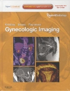 Douglas Brown, Douglas L. Brown, Julia Fielding, Julia R. Fielding, Amy Thurmond, Amy S. Thurmond - Gynecologic Imaging