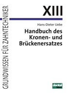Hans D Uebe, Hans-D Uebe, Hans-Dieter Uebe - Grundwissen für Zahntechniker - 13: Handbuch des Kronen- und Brückenersatzes