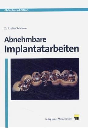 Axel Mühlhäuser - Abnehmbare Implantatarbeiten. Bd.1