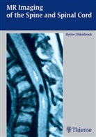 Detlev Uhlenbrock - MR Imaging of the Spine and Spinal Cord