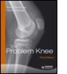 Malcolm Macnicol, Malcolm (Edinburgh Macnicol, Malcolm F. MacNicol, Malcolm/ Steenbrugge Macnicol, Macnicol Malcolm, Franky Steenbrugge... - The Problem Knee