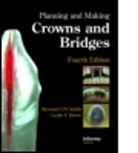 Leslie C. Howe, Leslie C. (Guy's Hospital Howe, Howe Leslie C., Bernard G. N. Smith, Bernard G. N. (Formerly Guy's Hospital Smith, Bernard G. N. (Formerly Guy''s Hospital Smith... - Planning and Making Crowns and Bridges