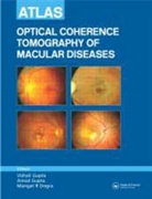 Mangat R. Dogra, Dogra Mangat R., Amod Gupta, Amod Dogra Gupta, Vishali Gupta, Vishali Gupta Gupta... - Atlas of Optical Coherence Tomography of Macular Diseases