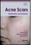 Antonella De Padova Tosti, Antonella Padova Tosti, TOSTI ANTONELLA DE PADOVA MARIA, Kenneth Beer, Kenneth R Beer, Maria De Padova... - Acne Scars