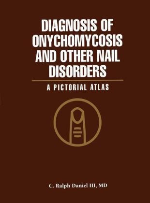 C Ralph III Daniel, C. R. Daniel, C. Ralph Daniel, C. Ralph III Daniel - Diagnosis of Onychomycosis and Other Nail Disorders - A Pictorial Atlas