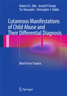Robert A Bilo, Robert A C Bilo, Robert A. C. Bilo, Robert A.C. Bilo, Christopher J. Hobbs, Arnold Oranje... - Cutaneous Manifestations of Child Abuse and Their Differential Diagnosis