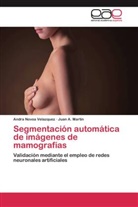 Juan A Martín, Juan A. Martín, Andr Novoa Velazquez, Andra Novoa Velazquez - Segmentación automática de imágenes de mamografías