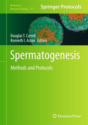 Kenneth I. Aston, Lor Barnard, Lori Barnard, Douglas T. Carrell, I Aston, … - Spermatogenesis Methods and Protocols