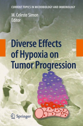 Celeste Simon, M Celeste Simon, M. Celeste Simon - Diverse Effects of Hypoxia on Tumor Progression
