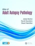 Burton, Julian Burton, Julian (The Medico-Legal Centre Burton, Julian Saunders Burton, Burton Julian, Stuart Hamilton... - Atlas of Adult Autopsy Pathology