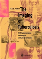 P E S Palmer, P. E. S. Palmer, P.E.S. Palmer - The Imaging of Tuberculosis