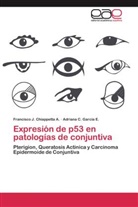 Francisco Chiappetta A, Francisco J Chiappetta A, Francisco J. Chiappetta A., Adriana C García E, Adriana C. García E. - Expresión de p53 en patologías de conjuntiva