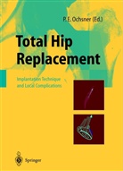 E Ochsner, P E Ochsner, P. E. Ochsner, P.E. Ochsner - Total Hip Replacement