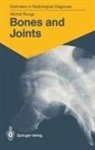 Michel Runge - Bones and Joints
