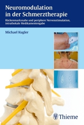Michael Kugler - Neuromodulation in der Schmerztherapie Rückenmarksnahe und periphere Nervenstimulation, intrathekale Medikamentengabe