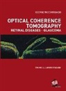 George Theodossiadis - Optical Coherence Tomography Retinal Diseases-glucoma
