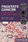 John D. Graham, AK Tewari, Ashutosh K. Tewari, Ashutosh K. (Weill Cornell Medical College Tewari, Ashutosh K. Whelan Tewari, Peter Whelan... - Prostate Cancer
