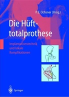Pete E Ochsner, Peter E Ochsner, Peter E. Ochsner - Die Hüfttotalprothese