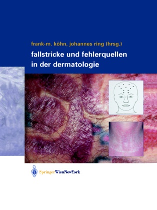 Frank-Michae Köhn, Frank-Michael Köhn, Ring, Ring, Johannes Ring - Fallstricke und Fehlerquellen in der Dermatologie