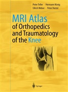Peter Hertel, Herman König, Hermann König, Pete Teller, Peter Teller, Ulrich Weber... - MRI Atlas of Orthopedics and Traumatology of the Knee