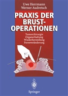 Werner Audretsch, Uw Herrmann, Uwe Herrmann - Praxis der Brustoperationen