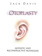 Jack Davis - Otoplasty