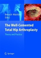 Steffen Breusch, Henrik Malchau - The Well-Cemented Total Hip Arthroplasty