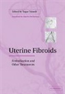 Togas Tulandi, Togas (Mcgill University Tulandi, Togas Tulandi, Tulandi Togas - Uterine Fibroids