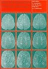 J. Rg Kesselring, Jrg Kesselring, Jurg Kesselring, Jürg Kesselring, Jurg (Rehabilitation Centre Kesselring, W. Ian McDonald... - Magnetic Resonance in Multiple Sclerosis