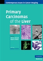 Hero Francis Hussain, Hero K. Hussain, Hero K. Francis Hussain, Isaac R Francis, Isaac R. Francis, Hero K Hussain... - Primary Carcinomas of the Liver