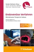 Jen Alm, Jens Alm, Franz-Xave Breu, Franz-Xaver Breu, Uldis Maurins, Uldis u a Maurins... - Endovenöse Verfahren