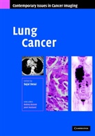 Sujal R. Desai, Sujal R. Desai - Lung Cancer