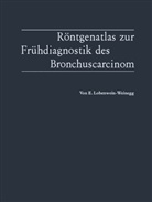 Elvira Lobenwein-Weinegg - Röntgenatlas zur Frühdiagnostik des Bronchuscarcinom