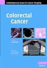 Gina Brown, Gina Brown - Colorectal Cancer