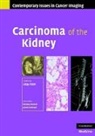 Uday Patel, Uday (St George''''s Hospital Patel, Uday Patel, Uday (St George's Hospital Patel - Carcinoma of the Kidney