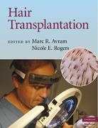 Marc R. Avram, Marc R. Rogers Avram, Marc Rogers Avram, Nicole E. Rogers, Rogers Nicole E., Marc R. Avram... - Hair Transplantation