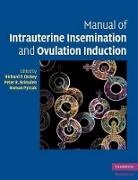 Richard P. Brinsden Dickey, Peter R. Brinsden, Brinsden Peter R., Richard P. Dickey, Dickey Richard P., Roman Pyrzak... - Manual of Intrauterine Insemination and Ovulation Induction