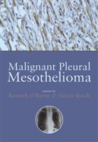 &amp;apos, Kenneth Rusch byrne, O&amp;apos, Kenneth O'Byrne, Kenneth (Consultant Oncologist O''''byrne, Kenneth Rusch O''''byrne... - Malignant Pleural Mesothelioma