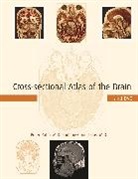Peter Ratiu, Ratiu Peter, Ion-Florin Talos, Talos Ion-Florin - Cross-Sectional Atlas of the Brain and DVD