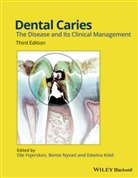 O Fejerskov, Ole Fejerskov, Ole (Aarhus University) Nyvad Fejerskov, Ole Nyvad Fejerskov, Edwina Kidd, Bente Nyvad... - Dental Caries