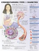 Anatomical Chart Company, Jeff Unger, Anatomical Chart Company - Understanding Type 1 Diabetes Anatomical Chart. Heavy Paper