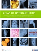 Nige Arden, Nigel Arden, Francisc Blanco, Francisco Blanco, C et al Cooper, C. Cooper... - Atlas of Osteoarthritis